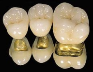 Ортопедические материалы в стоматологии