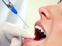 Анестезия при протезировании зубов