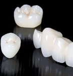 Протезирование зубов - технологии