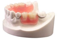 Протезирование зубов - противопоказания
